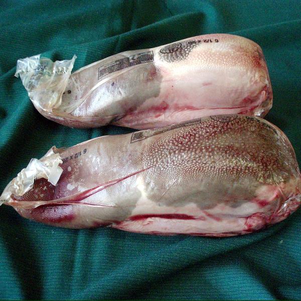 おねだん以上【　US産　牛黒タン・皮先付　】チルド　冷凍