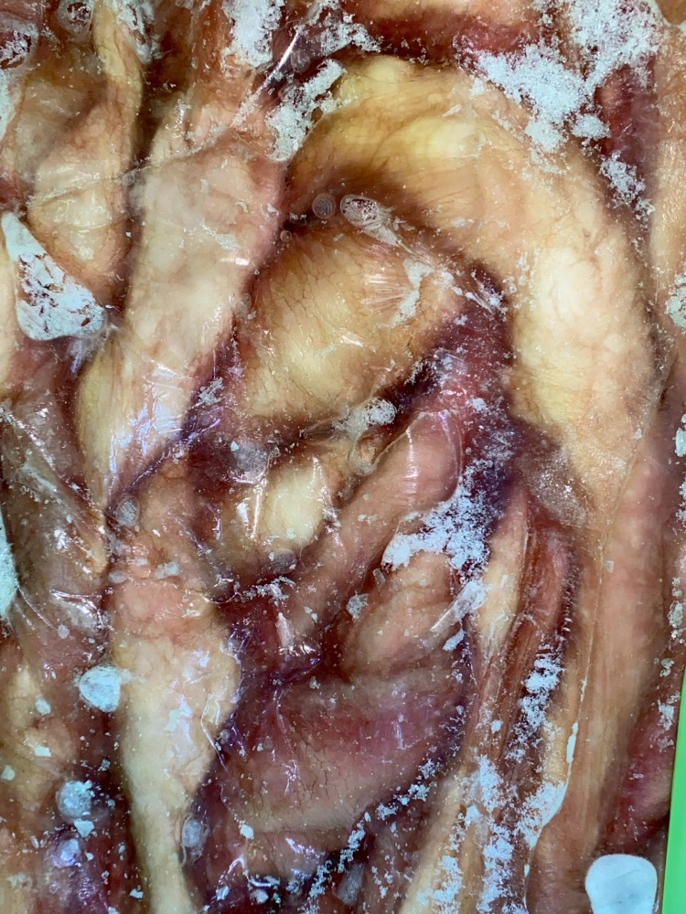 ���Y���@�}���`���E�i�z���k�L�j�Ⓚ�@�P�[�X�̔�